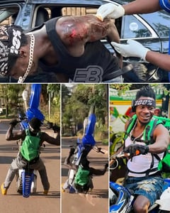 Singer Alien skin nursing wounds after a motorcycle accident 