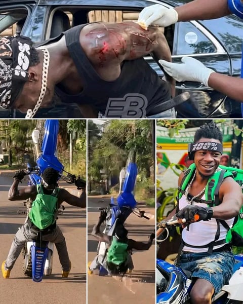 Singer Alien skin nursing wounds after a motorcycle accident 