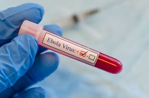 Uganda Confirms Ebola Virus Outbreak as One Dies from the Sudan Variant